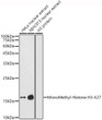 Western blot analysis of extracts of various cell lines, using MonoMethyl-Histone H3-K27 antibody (STJ23987) at 1:1000 dilution. Secondary antibody: HRP Goat Anti-rabbit IgG (H+L) (STJS000856) at 1:10000 dilution. Lysates/proteins: 25 Mu g per lane. Blocking buffer: 3% non-fat dry milk in TBST. Detection: ECL Enhanced Kit. Exposure time: 180s.