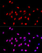 Immunofluorescence analysis of NIH/3T3 cells using MonoMethyl-Histone H3-K27 rabbit polyclonal antibody (STJ23987) at dilution of 1:100 (40x lens). Blue: DAPI for nuclear staining.