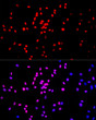 Immunofluorescence analysis of PC-12 cells using MonoMethyl-Histone H3-K27 rabbit polyclonal antibody (STJ23987) at dilution of 1:100 (40x lens). Blue: DAPI for nuclear staining.