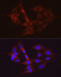 Immunofluorescence analysis of PC-12 cells using Hexokinase II Rabbit polyclonal antibody (STJ24020) at dilution of 1:100 (40x lens). Secondary antibody: Cy3 Goat Anti-Rabbit IgG (H+L) at 1:500 dilution. Blue: DAPI for nuclear staining.
