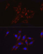 Immunofluorescence analysis of NIH/3T3 cells using Hexokinase II Rabbit polyclonal antibody (STJ24020) at dilution of 1:100 (40x lens). Secondary antibody: Cy3 Goat Anti-Rabbit IgG (H+L) at 1:500 dilution. Blue: DAPI for nuclear staining.