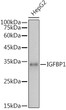 Western blot analysis of extracts of HepG2 cells, using IGFBP1 antibody (STJ24145) at 1:1000 dilution. Secondary antibody: HRP Goat Anti-Rabbit IgG (H+L) (STJS000856) at 1:10000 dilution. Lysates/proteins: 25 Mu g per lane. Blocking buffer: 3% nonfat dry milk in TBST. Detection: ECL Basic Kit. Exposure time: 3s.