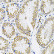 Immunohistochemistry analysis of paraffin-embedded human stomach using IL13 antibody (STJ24163) (40x lens). Perform microwave antigen retrieval with 10 mM PBS buffer pH 7. 2 before commencing with immunohistochemistry staining protocol.