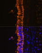 Immunofluorescence analysis of rat bronchus cells using Cytokeratin 7 (Cytokeratin 7 (KRT7) ) antibody (STJ24364) at dilution of 1:100. Blue: DAPI for nuclear staining.