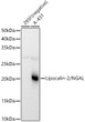Western blot analysis of extracts of various cell lines, using Lipocalin-2/NGAL antibody (STJ24382) at 1:1000 dilution. Secondary antibody: HRP Goat Anti-Rabbit IgG (H+L) (STJS000856) at 1:10000 dilution. Lysates/proteins: 25 Mu g per lane. Blocking buffer: 3% nonfat dry milk in TBST. Detection: ECL Basic Kit. Exposure time: 1s.