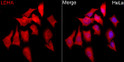 Immunofluorescence analysis of HeLa cells using LDHA Rabbit polyclonal antibody (STJ24386) at dilution of 1:50 (40x lens). Secondary antibody: Cy3 Goat Anti-Rabbit IgG (H+L) at 1:500 dilution. Blue: DAPI for nuclear staining.