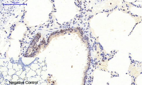 STJ91357_7_IHC__57146.