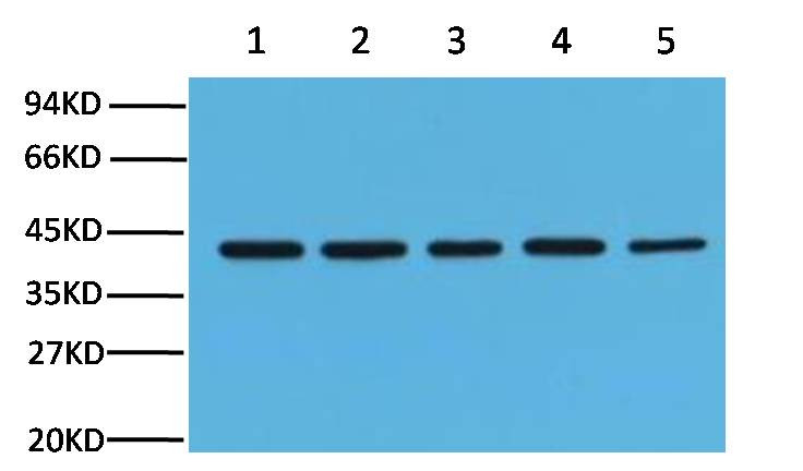 Anti-ACTB STJ96930