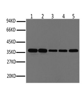 Anti-GAPDH STJ96931
