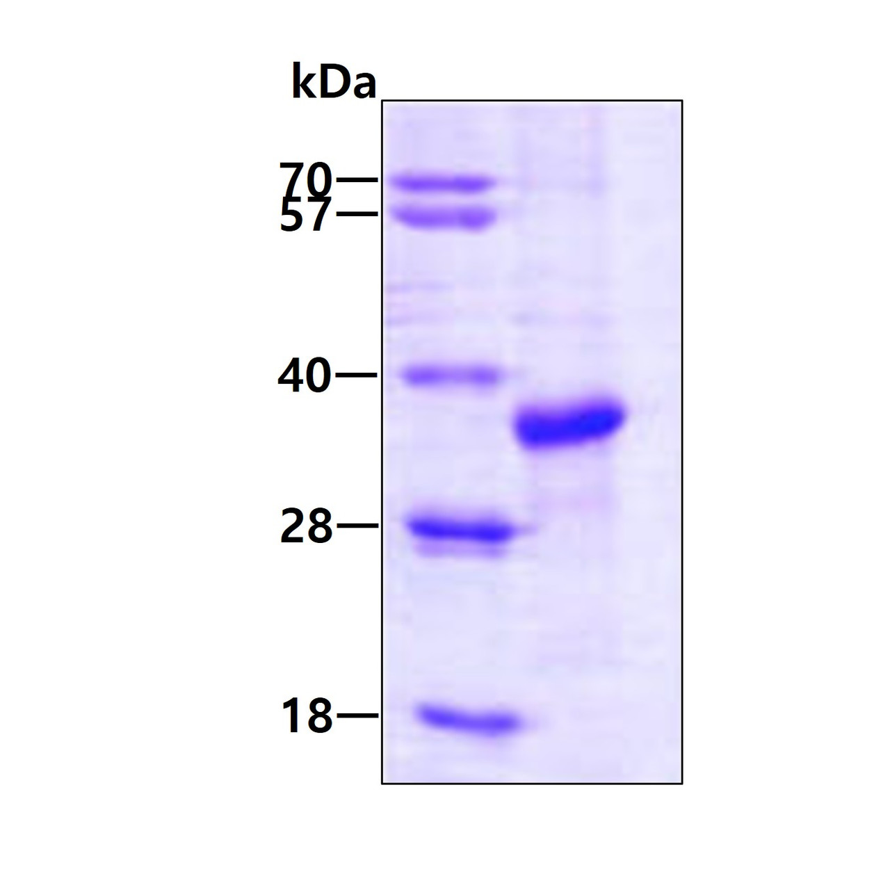 Recombinant-HumanCHIP/STUB1-No-Tag(E.coli)