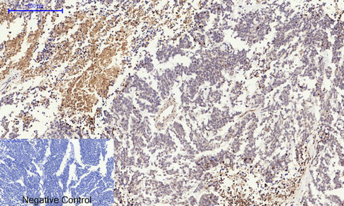 Top 5 tips: Immunohistochemistry