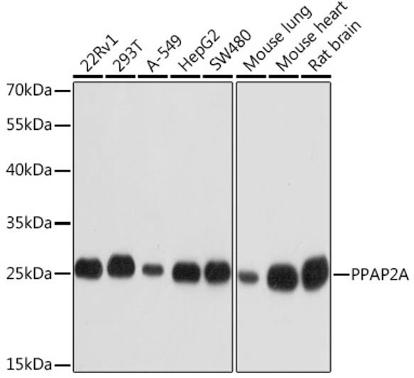 Western blot analysis of extracts of various cell lines, using PPAP2A Rabbit polyclonal antibody (STJ25067) at 1:1000 dilution. Secondary antibody: HRP Goat Anti-Rabbit IgG (H+L) (STJS000856) at 1:10000 dilution. Lysates/proteins: 25 Mu g per lane. Blocking buffer: 3% nonfat dry milk in TBST. Detection: ECL Basic Kit. Exposure time: 1s. Western blot analysis of extracts of various cell lines, using PPAP2A Rabbit polyclonal antibody (STJ25067) at 1:1000 dilution. Secondary antibody: HRP Goat Anti-Rabbit IgG (H+L) (STJS000856) at 1:10000 dilution. Lysates/proteins: 25 Mu g per lane. Blocking buffer: 3% nonfat dry milk in TBST. Detection: ECL Basic Kit. Exposure time: 1s.