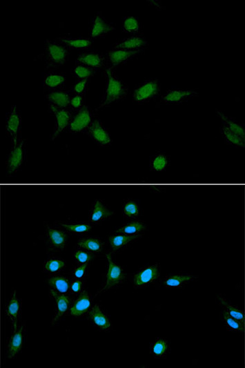 Immunofluorescence analysis of U2OS cells using PSMA1 antibody (STJ25170) at dilution of 1:100. Blue: DAPI for nuclear staining.