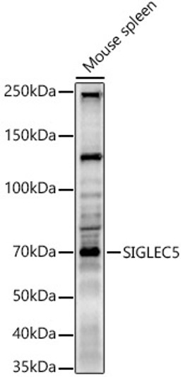 Western blot analysis of Mouse spleen, using SIGLEC5 Rabbit polyclonal antibody (STJ26591) at 1:800 dilution. Secondary antibody: HRP Goat Anti-Rabbit IgG (H+L) (STJS000856) at 1:10000 dilution. Lysates/proteins: 25 Mu g per lane. Blocking buffer: 3% nonfat dry milk in TBST. Detection: ECL Basic Kit. Exposure time: 90s.