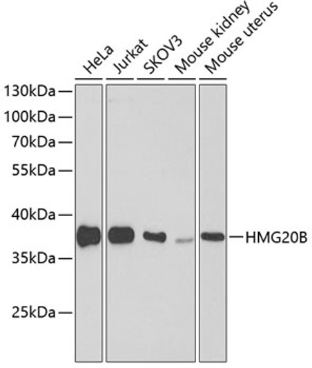 Western blot analysis of extracts of various cell lines, using HMG20B antibody (STJ26659) at 1:1000 dilution. Secondary antibody: HRP Goat Anti-rabbit IgG (H+L) at 1:10000 dilution. Lysates/proteins: 25ug per lane. Blocking buffer: 3% non-fat dry milk in TBST. Detection: ECL Basic Kit. Exposure time: 90s.