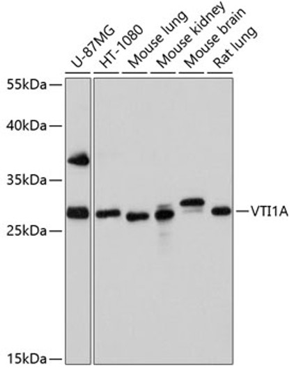 Western blot analysis of extracts of various cell lines, using VTI1A antibody (STJ27141) at 1:1000 dilution. Secondary antibody: HRP Goat Anti-Rabbit IgG (H+L) (STJS000856) at 1:10000 dilution. Lysates/proteins: 25 Mu g per lane. Blocking buffer: 3% nonfat dry milk in TBST. Detection: ECL Basic Kit. Exposure time: 90s.