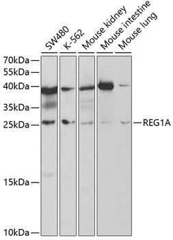 Western blot analysis of extracts of various cell lines, using REG1A antibody (STJ27280) at 1:1000 dilution. _Secondary antibody: HRP Goat Anti-Rabbit IgG (H+L) (STJS000856) at 1:10000 dilution. _Lysates/proteins: 25 Mu g per lane. _Blocking buffer: 3% nonfat dry milk in TBST. _Detection: ECL Basic Kit. _Exposure time: 60s.