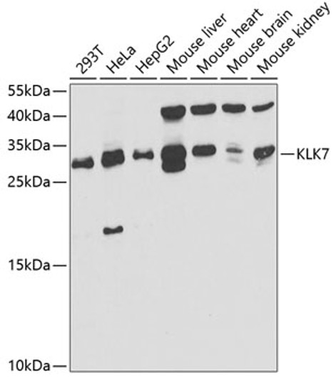 Western blot analysis of extracts of various cell lines, using KLK7 antibody (STJ27457) at 1:1000 dilution. Secondary antibody: HRP Goat Anti-Rabbit IgG (H+L) (STJS000856) at 1:10000 dilution. Lysates/proteins: 25 Mu g per lane. Blocking buffer: 3% nonfat dry milk in TBST. Detection: ECL Basic Kit. Exposure time: 90s.