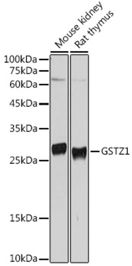 Western blot analysis of extracts of various cell lines, using GSTZ1 antibody (STJ27882) at 1:500 dilution. Secondary antibody: HRP Goat Anti-Rabbit IgG (H+L) (STJS000856) at 1:10000 dilution. Lysates/proteins: 25 Mu g per lane. Blocking buffer: 3% nonfat dry milk in TBST. Detection: ECL Basic Kit. Exposure time: 10s.