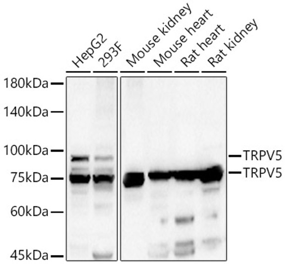 Western blot analysis of various lysates, using TRPV5 rabbit polyclonal antibody (STJ28556) at 1:500 dilution. Secondary antibody: HRP Goat Anti-rabbit IgG (H+L) (STJS000856) at 1:10000 dilution. Lysates/proteins: 25 Mu g per lane. Blocking buffer: 3% non-fat dry milk in TBST. Detection: ECL Basic Kit. Exposure time: 60s.
