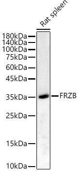 Western blot analysis of lysates from Rat spleen, using FRZB Rabbit polyclonal antibody (STJ28675) at 1:6000 dilution. Secondary antibody: HRP Goat Anti-Rabbit IgG (H+L) (STJS000856) at 1:10000 dilution. Lysates/proteins: 25 Mu g per lane. Blocking buffer: 3% nonfat dry milk in TBST. Detection: ECL Basic Kit. Exposure time: 90s.
