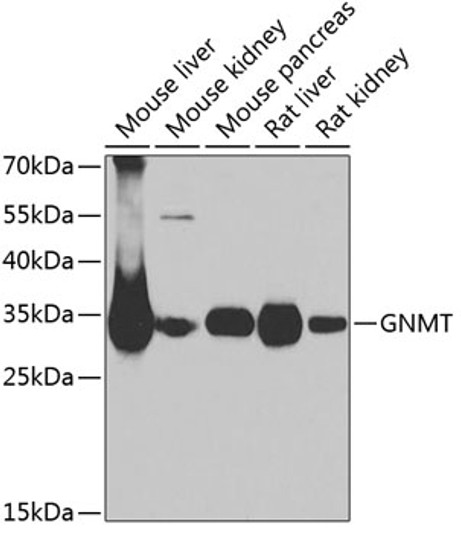Western blot analysis of extracts of various cell lines, using GNMT antibody (STJ28691) at 1:1000 dilution. Secondary antibody: HRP Goat Anti-Rabbit IgG (H+L) (STJS000856) at 1:10000 dilution. Lysates/proteins: 25 Mu g per lane. Blocking buffer: 3% nonfat dry milk in TBST. Detection: ECL Basic Kit. Exposure time: 90s.