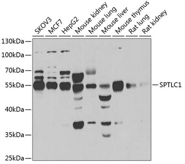 Western blot analysis of extracts of various cell lines, using SPTLC1 antibody (STJ28833) at 1:1000 dilution. Secondary antibody: HRP Goat Anti-Rabbit IgG (H+L) (STJS000856) at 1:10000 dilution. Lysates/proteins: 25 Mu g per lane. Blocking buffer: 3% nonfat dry milk in TBST. Detection: ECL Basic Kit. Exposure time: 90s. Western blot analysis of extracts of various cell lines, using SPTLC1 antibody (STJ28833) at 1:1000 dilution. Secondary antibody: HRP Goat Anti-Rabbit IgG (H+L) (STJS000856) at 1:10000 dilution. Lysates/proteins: 25 Mu g per lane. Blocking buffer: 3% nonfat dry milk in TBST. Detection: ECL Basic Kit. Exposure time: 90s.