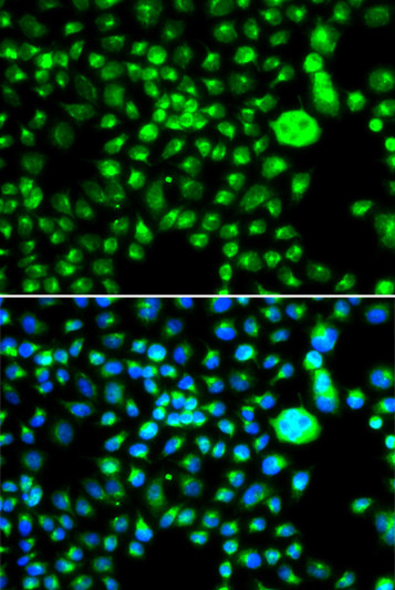 Immunofluorescence analysis of MCF-7 cells using SMCHD1 antibody (STJ29294). Blue: DAPI for nuclear staining.