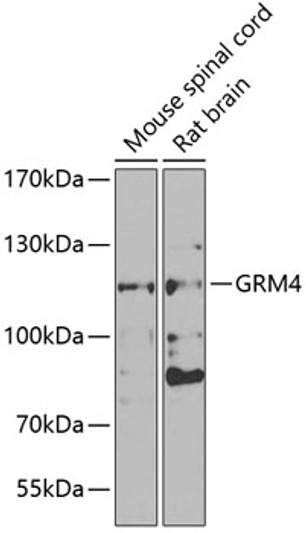Western blot analysis of extracts of various cell lines, using GRM4 antibody (STJ29423) at 1:1000 dilution. Secondary antibody: HRP Goat Anti-Rabbit IgG (H+L) (STJS000856) at 1:10000 dilution. Lysates/proteins: 25 Mu g per lane. Blocking buffer: 3% nonfat dry milk in TBST. Detection: ECL Basic Kit. Exposure time: 90s.