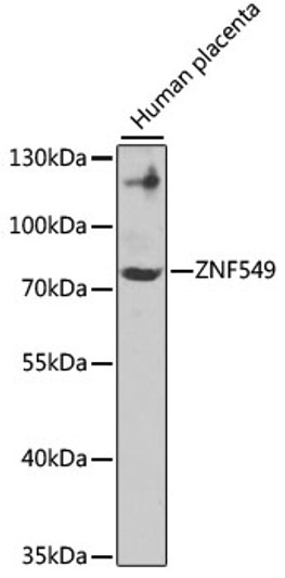 Western blot analysis of lysates from Human placenta, using ZNF549 Rabbit pAb (STJ29542). <br/>Secondary antibody: HRP-conjugated Goat anti-Rabbit IgG (H+L) (STJS000856) at 1:10000 dilution. <br/>Lysates/proteins: 25 Mu g per lane. <br/>Blocking buffer: 3% nonfat dry milk in TBST. <br/>Detection: ECL Enhanced Kit <br/>Exposure time: 90s.