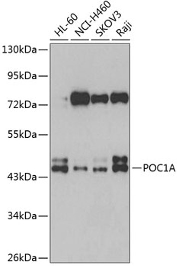 Western blot analysis of extracts of various cell lines, using POC1A antibody (STJ29601) at 1:1000 dilution. Secondary antibody: HRP Goat Anti-Rabbit IgG (H+L) (STJS000856) at 1:10000 dilution. Lysates/proteins: 25 Mu g per lane. Blocking buffer: 3% nonfat dry milk in TBST. Detection: ECL Basic Kit. Exposure time: 90s.