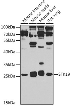 Western blot analysis of extracts of various cell lines, using STK19 antibody (STJ29711) at 1:1000 dilution. Secondary antibody: HRP Goat Anti-Rabbit IgG (H+L) (STJS000856) at 1:10000 dilution. Lysates/proteins: 25 Mu g per lane. Blocking buffer: 3% nonfat dry milk in TBST. Detection: ECL Basic Kit. Exposure time: 90s.