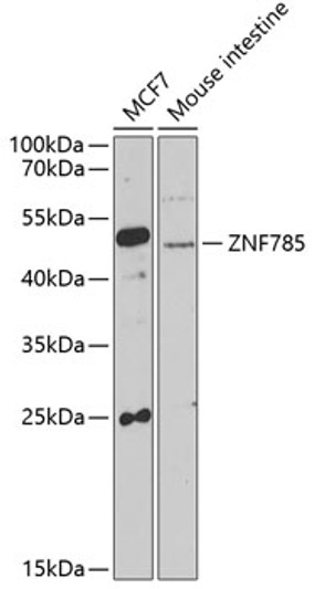 Western blot analysis of various lysates using ZNF785 Rabbit polyclonal antibody (STJ29747) at 1:1000 dilution. Secondary antibody: HRP Goat Anti-Rabbit IgG (H+L) (STJS000856) at 1:10000 dilution. Lysates/proteins: 25 Mu g per lane. Blocking buffer: 3% nonfat dry milk in TBST. Detection: ECL Basic Kit. Exposure time: 90s.