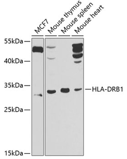 Western blot analysis of extracts of various cell lines, using HLA-DRB1 antibody (STJ29998) at 1:1000 dilution. _Secondary antibody: HRP Goat Anti-Rabbit IgG (H+L) (STJS000856) at 1:10000 dilution. _Lysates/proteins: 25 Mu g per lane. _Blocking buffer: 3% nonfat dry milk in TBST. _Detection: ECL Basic Kit. _Exposure time: 30s.
