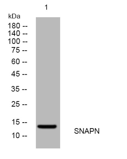 Western blot analysis of lysates from HEK293 cells, primary antibody was diluted at 1:1000, 4°C over night