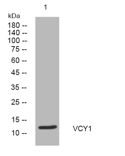 Western blot analysis of lysates from DU145 cells, primary antibody was diluted at 1:1000, 4°C over night