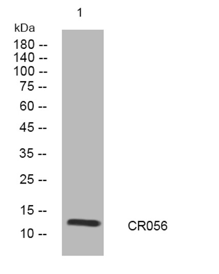 Western blot analysis of lysates from MCF-7 cells, primary antibody was diluted at 1:1000, 4°C over night