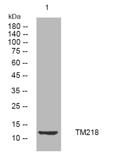 Western blot analysis of lysates from DU145 cells, primary antibody was diluted at 1:1000, 4°C over night Western blot analysis of lysates from DU145 cells, primary antibody was diluted at 1:1000, 4°C over night