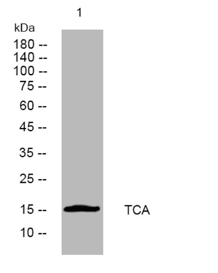 Western blot analysis of lysates from U2OS cells, primary antibody was diluted at 1:1000, 4°C over night