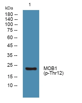 Western blot analysis of lysates from U2OS cells, primary antibody was diluted at 1:1000, 4°C overnight STJ194726