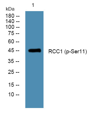 Western blot analysis of lysates from Jurkat cells, primary antibody was diluted at 1:1000, 4°C overnight STJ194740