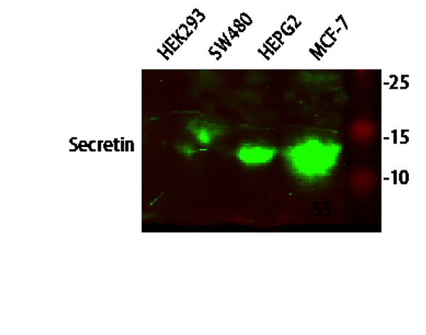 Western blot analysis of various lysates, primary antibody was diluted at 1:1000, 4°C over night, secondary antibody (cat： (NA) was diluted at 1:10000, 37°C 1hour.