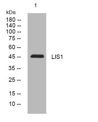 Western blot analysis of lysates from KB cells, primary antibody was diluted at 1:1000, 4°C overnight STJ194819