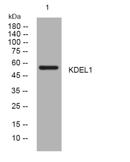 Western blot analysis of lysates from KB cells, primary antibody was diluted at 1:1000, 4°C over night
