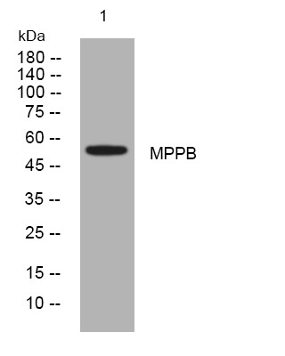 Western blot analysis of lysates from 293T cells, primary antibody was diluted at 1:1000, 4°C overnight STJ194912