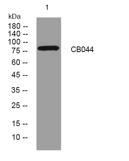 Western blot analysis of lysates from A549 cells, primary antibody was diluted at 1:1000, 4°C over night