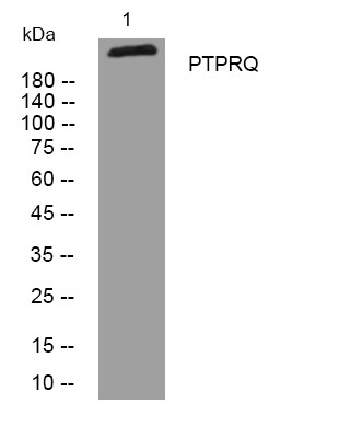 Western blot analysis of lysates from KB cells, primary antibody was diluted at 1:1000, 4°C overnight STJ194994