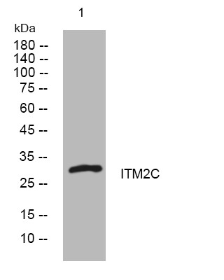 Western blot analysis of lysates from MDA-MB cells, primary antibody was diluted at 1:1000, 4° overnight STJ195090