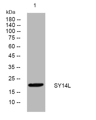 Western blot analysis of lysates from MCF-7 cells, primary antibody was diluted at 1:1000, 4°C overnight STJ195101