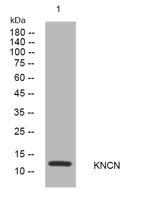 Western blot analysis of lysates from A549 cells, primary antibody was diluted at 1:1000, 4°C overnight STJ195113